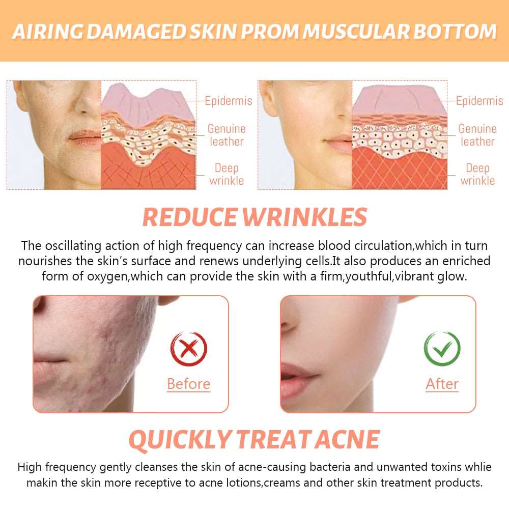 4 In 1 High Frequency Electrode Wand Electrotherapy Glass Tube