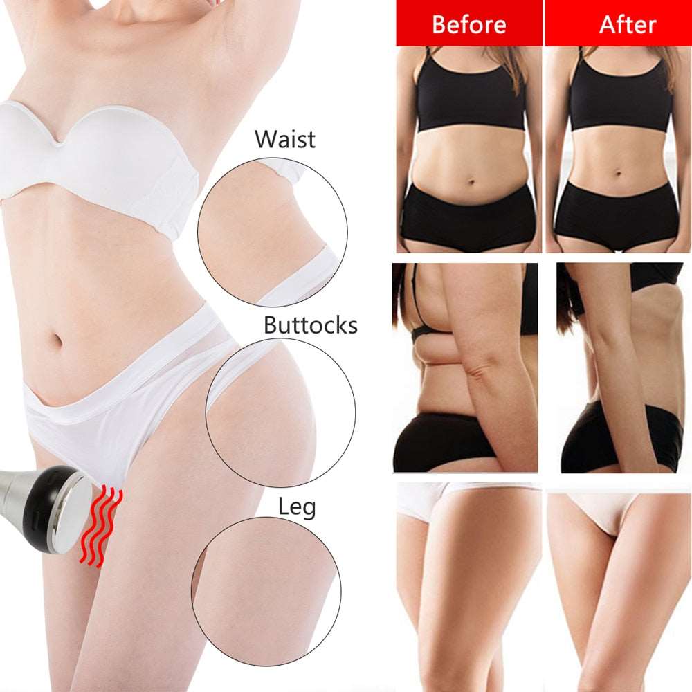 Cavitation Ultrasonic Body Slimming Machine